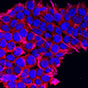 MIF-Induced Mesenchymal Marker in Pancreatic Cancer. Source: NCI Center for Cancer Research